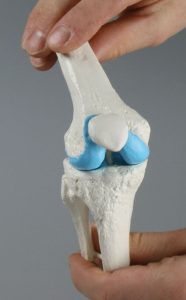 Knie-implantaat model