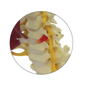 Cervicale wervelkolom met zenuwen en spieren