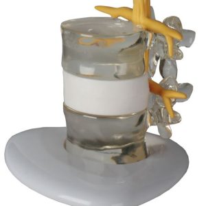 Demonstratie Lumbale Hernia, 2x ware grootte