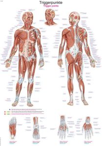 Anatomie Poster Triggerpoints