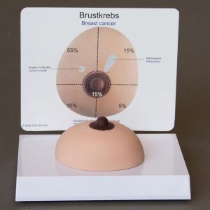 Borstkanker, zacht weefsel