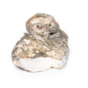 Fibreuze Tuberculose, 3D Print