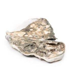 Fibreuze Tuberculose, 3D Print