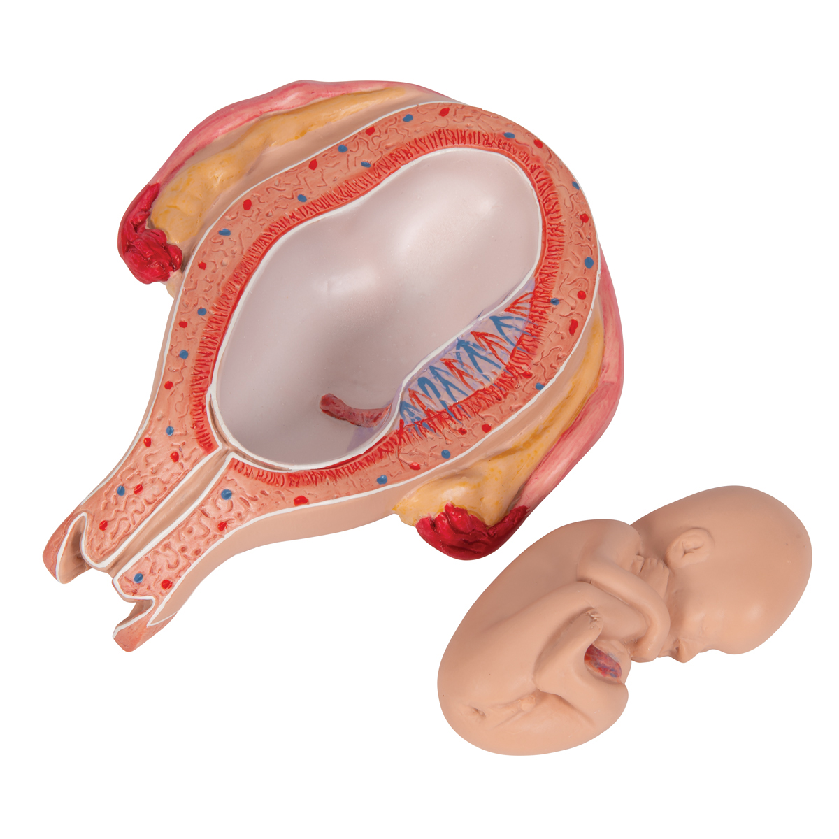 Foetus model stuitligging maand 5