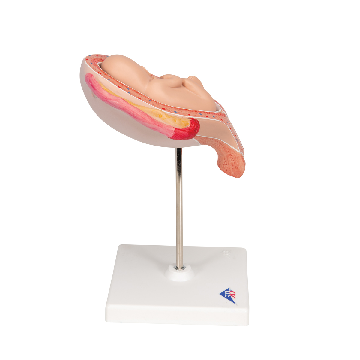 Foetus model stuitligging maand 5
