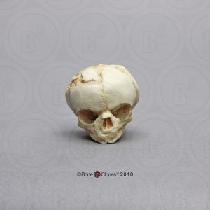 Foetus schedel 17 weken