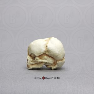 Foetus schedel 17 weken