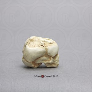 Foetus schedel 17 weken