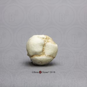 Foetus schedel 17 weken