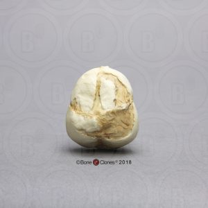 Foetus schedel 17 weken