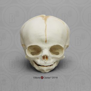 Foetus schedel 30 weken