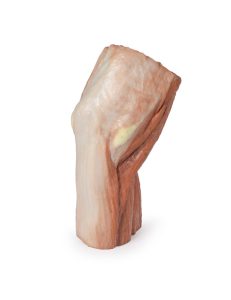 Fossa Cubitalis links, 3D Print
