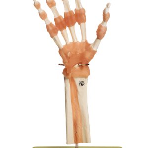 Functioneel Model Hand- en Vingergewrichten