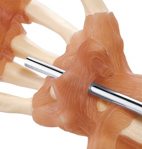 Functioneel Model Hand- en Vingergewrichten