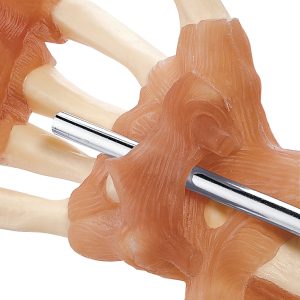 Functioneel Model Hand- en Vingergewrichten