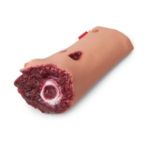 Geamputeerd Been voor Wondsimulatie