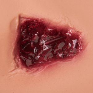 Geamputeerd Been voor Wondsimulatie