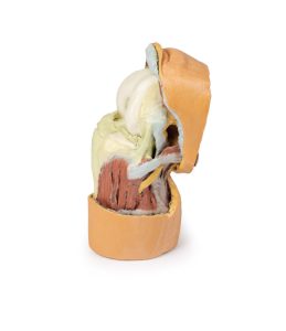 Gebogen knie met diepe dissectie, 3Dprint