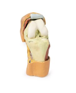 Gebogen knie met diepe dissectie, 3Dprint