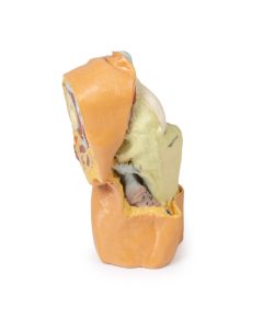 Gebogen knie met diepe dissectie, 3Dprint