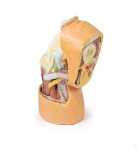 Gebogen knie met diepe dissectie, 3Dprint