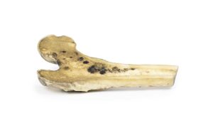 Gemetastaseerd Maligne Melanoom, 3D Print