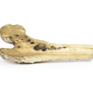 Gemetastaseerd Maligne Melanoom, 3D Print
