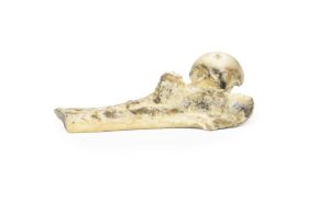 Gemetastaseerd Maligne Melanoom, 3D Print