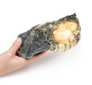 Gemetastaseerde Tumor in Long van eerdere teelbalkanker, 3D Print