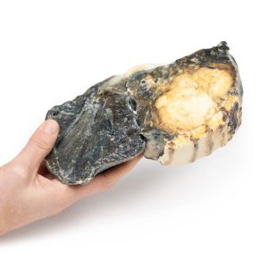 Gemetastaseerde Tumor in Long van eerdere teelbalkanker, 3D Print