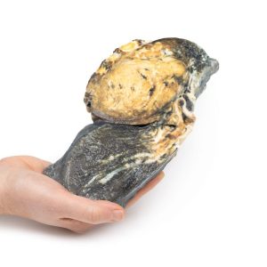 Gemetastaseerde Tumor in Long van eerdere teelbalkanker, 3D Print