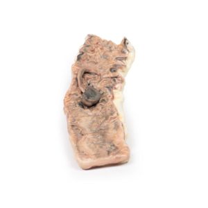 Gesteeld Adenoom in de Dikke Darm, 3D Print