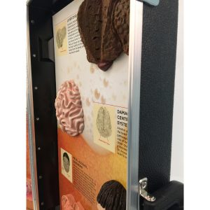 Gevolgen van Alcoholmisbruik, 3D Display