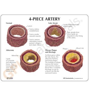 4-delig Arteriemodel + infokaart
