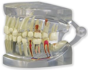Transparant Kaakmodel met gebit