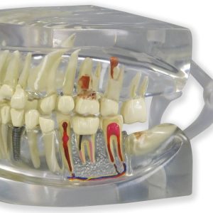 Transparant Kaakmodel met gebit