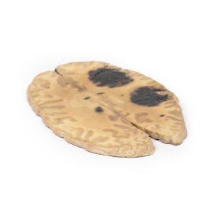 Hersenbloeding, secundair aan AML, 3D Print