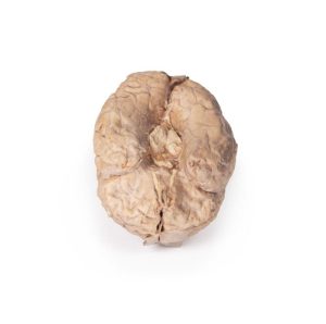 Hersenen (Cerebrum), 3D Print