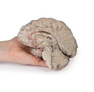 Hersenen Hemisectie, 3D Print
