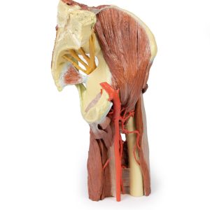 Linker heup & dij, diepe dissectie, 3Dprint