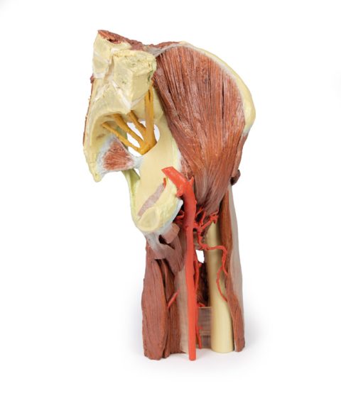 Linker heup & dij, diepe dissectie, 3Dprint
