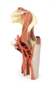 Linker heup & dij, diepe dissectie, 3Dprint