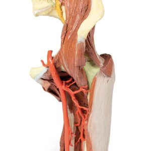 Linker heup & dij, diepe dissectie, 3Dprint