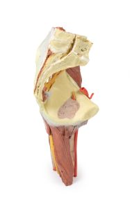 Linker heup & dij, diepe dissectie, 3Dprint