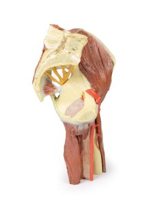 Linker heup & dij, diepe dissectie, 3Dprint