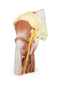 Linker heup & dij, diepe dissectie, 3Dprint