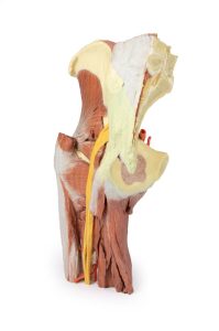 Linker heup & dij, diepe dissectie, 3Dprint