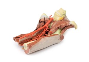 Linker heup & dij, diepe dissectie, 3Dprint