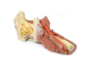 Linker heup & dij, diepe dissectie, 3Dprint