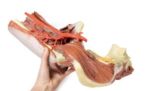 Linker heup & dij, diepe dissectie, 3Dprint